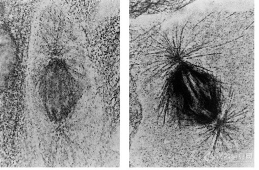 light micrograph of nanogold vs. colloidal gold-labeled microtubules (81k)