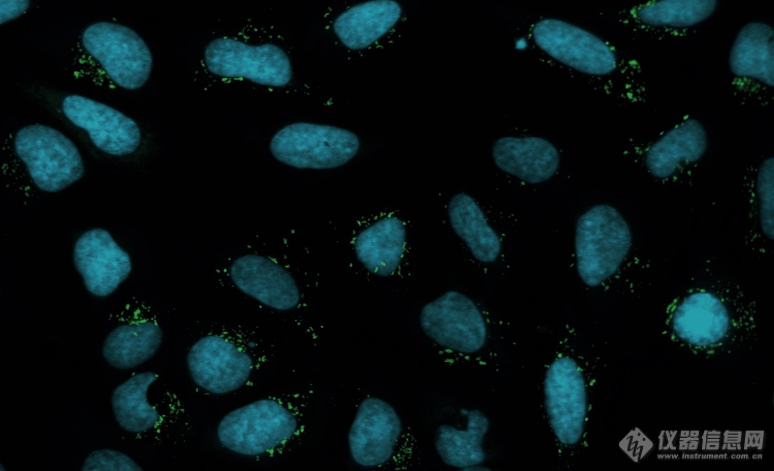 【网络讲堂预告】高质量细胞形态分析应用实例分享-Molecular Devices