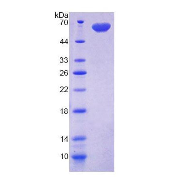 DIO2蛋白；碘甲腺原氨酸脱碘酶Ⅱ(DIO2)重组蛋白