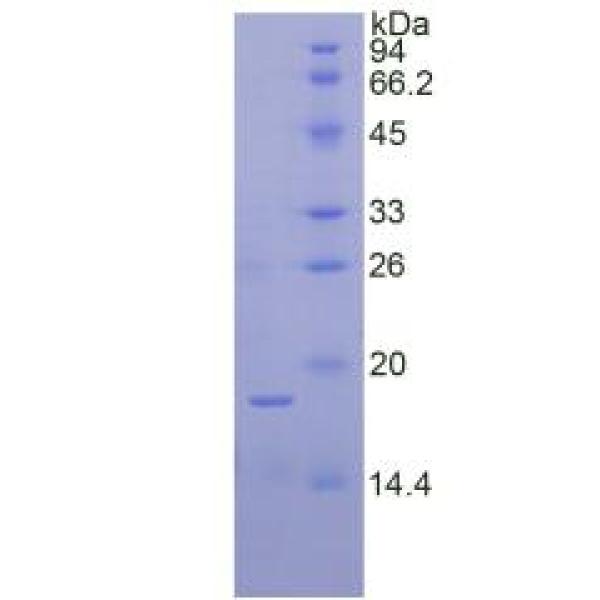 RNASE7蛋白；核糖核酸酶A7(RNASE7)重组蛋白