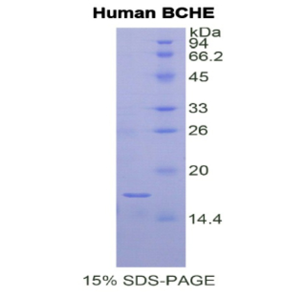 BCHE蛋白；丁酰胆碱酯酶(BCHE)重组蛋白