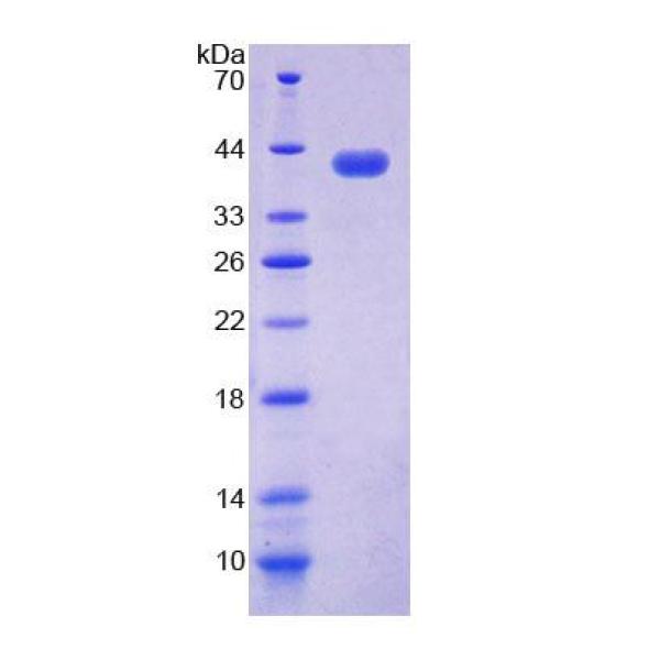 NAP1L1蛋白；核小体装配蛋白1样1(NAP1L1)重组蛋白