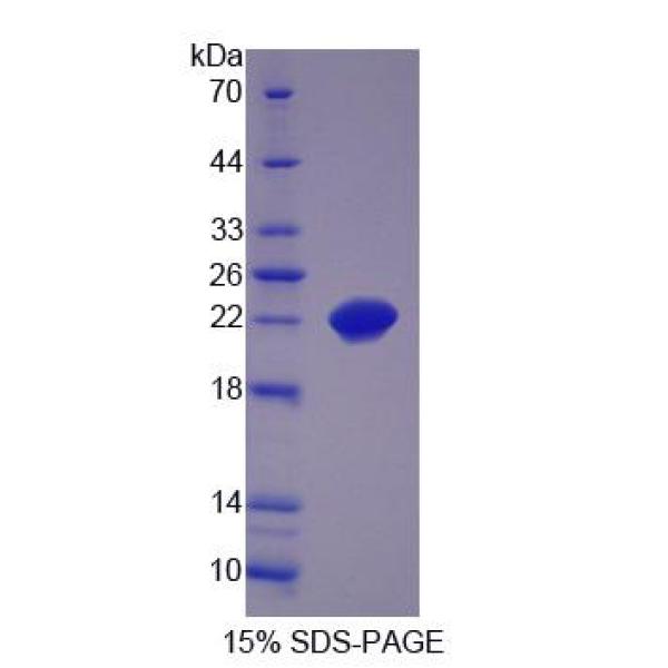 SCAND3蛋白；含SCAN域蛋白3(SCAND3)重组蛋白