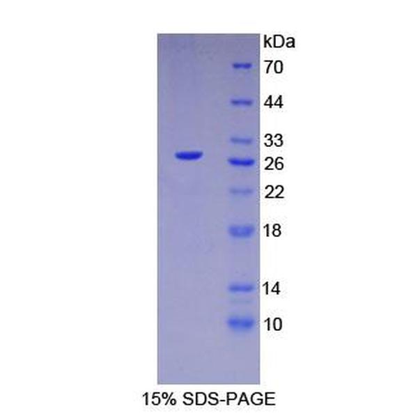 HNF4a蛋白；肝细胞核因子4α(HNF4a)重组蛋白