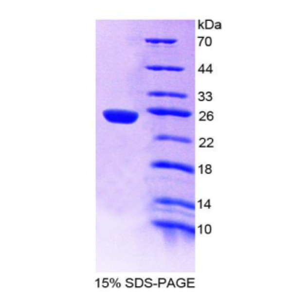 PSMB9蛋白；多功能肽酶2(PSMB9)重组蛋白
