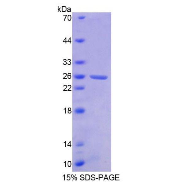 BCR蛋白；断裂点簇集群区(BCR)重组蛋白