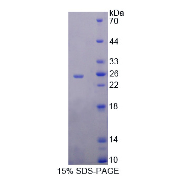 RNASE9蛋白；核糖核酸酶A9(RNASE9)重组蛋白