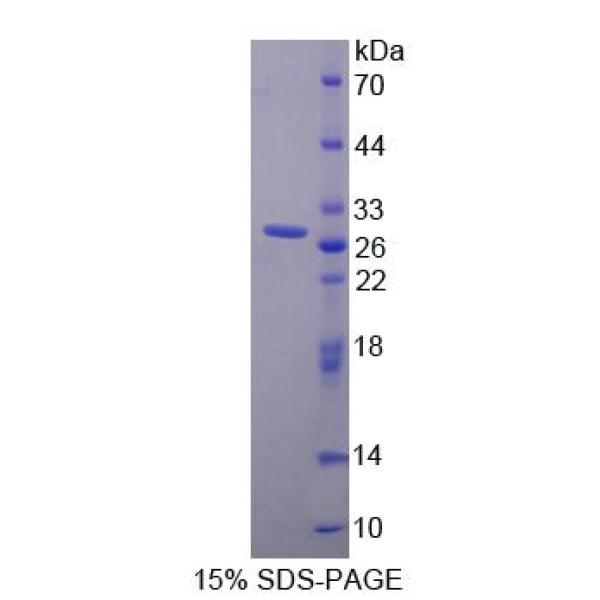 STIM1蛋白；基质相互作用分子1(STIM1)重组蛋白