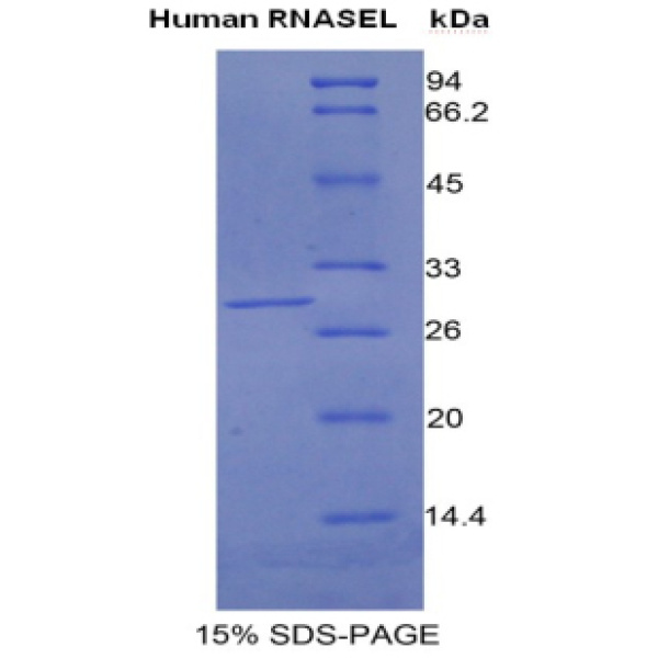RNASEL蛋白；核糖核酸酶L(RNASEL)重组蛋白