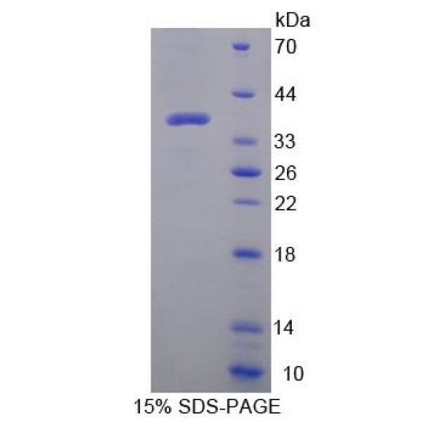 DEFa2蛋白；防御素α2(DEFa2)重组蛋白