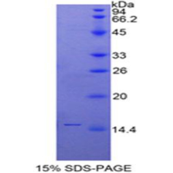 SLURP1蛋白；分泌型Ly6/uPAR相关蛋白1(SLURP1)重组蛋白