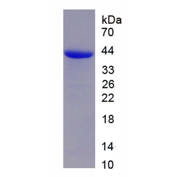 KCC2蛋白；钾氯协同转运蛋白2(KCC2)重组蛋白