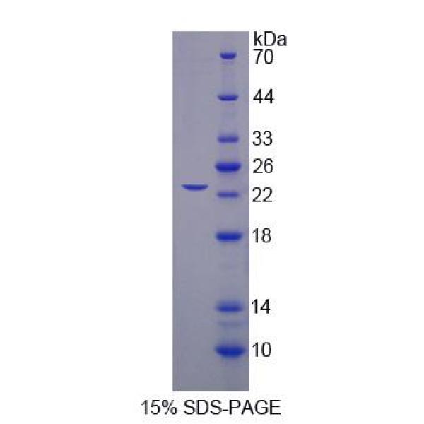 SF3B3蛋白；剪接因子3B亚基3(SF3B3)重组蛋白