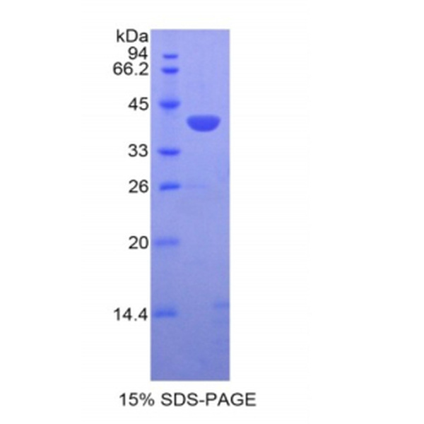 SLC蛋白；二级淋巴组织趋化因子(SLC)重组蛋白