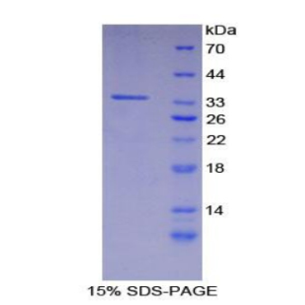 CARD9蛋白；胱天蛋白酶富集域家族成员9(CARD9)重组蛋白
