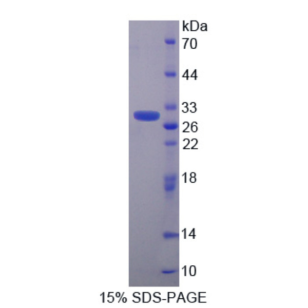 CACYBP蛋白；钙周期素结合蛋白(CACYBP)重组蛋白