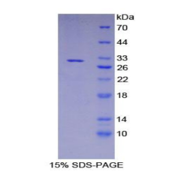 APBA3蛋白；淀粉样蛋白β前体蛋白结合蛋白A3(APBA3)重组蛋白
