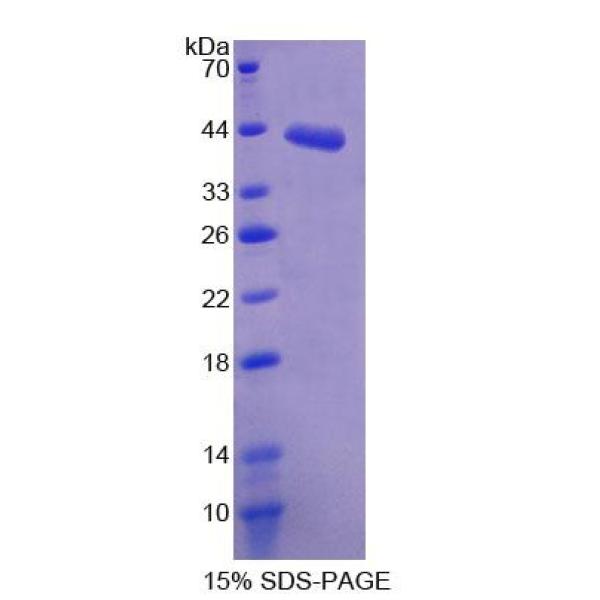 SDHC蛋白；琥珀酸脱氢酶复合体C亚基(SDHC)重组蛋白