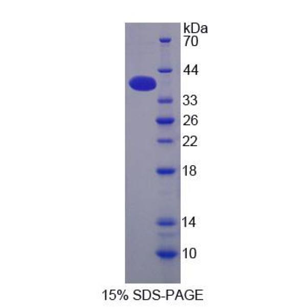 CPSF1蛋白；剪切多聚腺苷酸化特异性因子1(CPSF1)重组蛋白