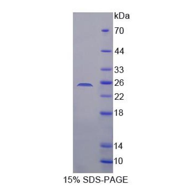 SDHB蛋白；琥珀酸脱氢酶复合体B亚基(SDHB)重组蛋白
