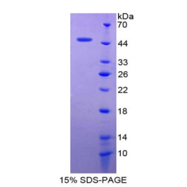 CLDN1蛋白；封闭蛋白1(CLDN1)重组蛋白