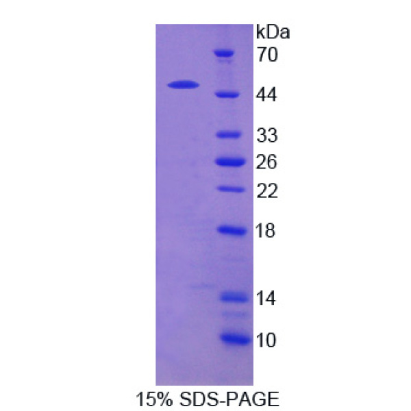 SPRED2蛋白；含侧支发芽因子相关EVH1域蛋白2(SPRED2)重组蛋白
