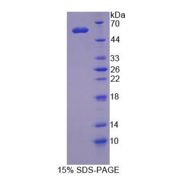 MRE11A蛋白；减数分裂重组11同源物A(MRE11A)重组蛋白
