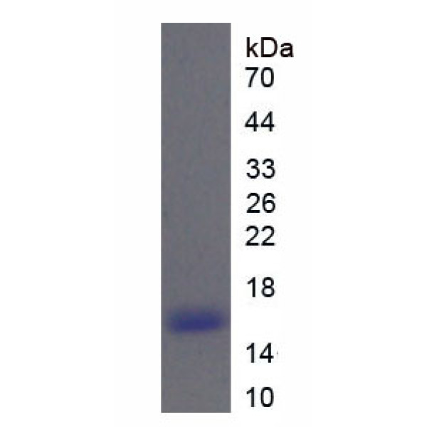RNASE6蛋白；核糖核酸酶A6(RNASE6)重组蛋白