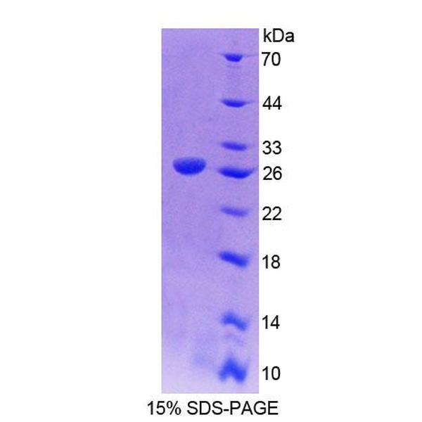 CDH15蛋白；肌微管钙黏附蛋白(CDH15)重组蛋白