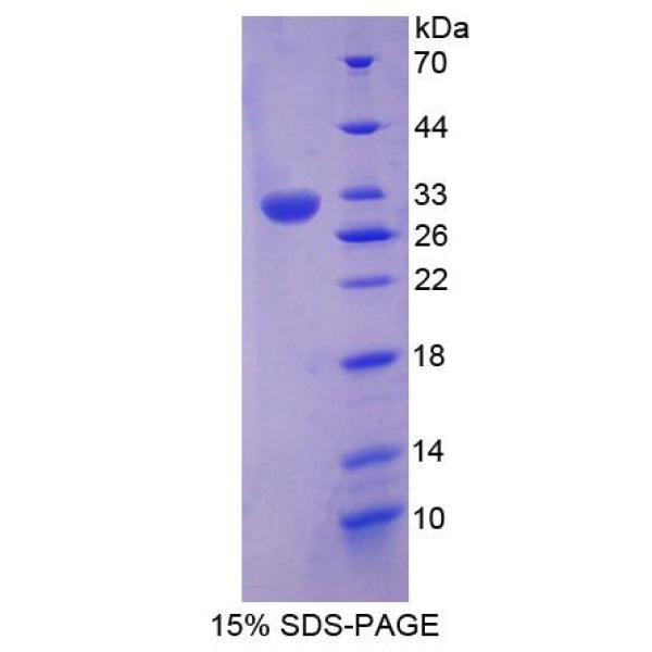 CSDE1蛋白；含RNA结合冷休克域蛋白E1(CSDE1)重组蛋白