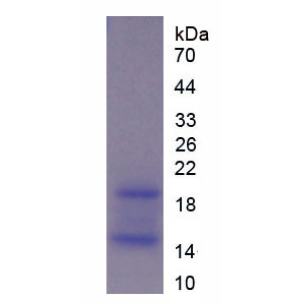 RNASE12蛋白；核糖核酸酶A12(RNASE12)重组蛋白