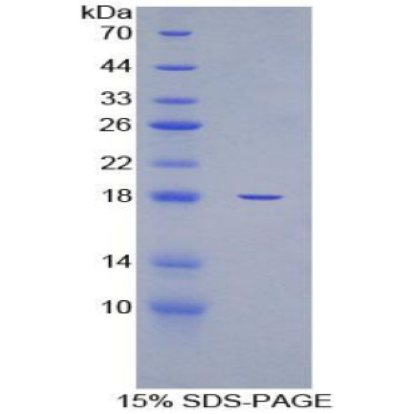 GAPDH蛋白；甘油醛-3-磷酸脱氢酶(GAPDH)重组蛋白