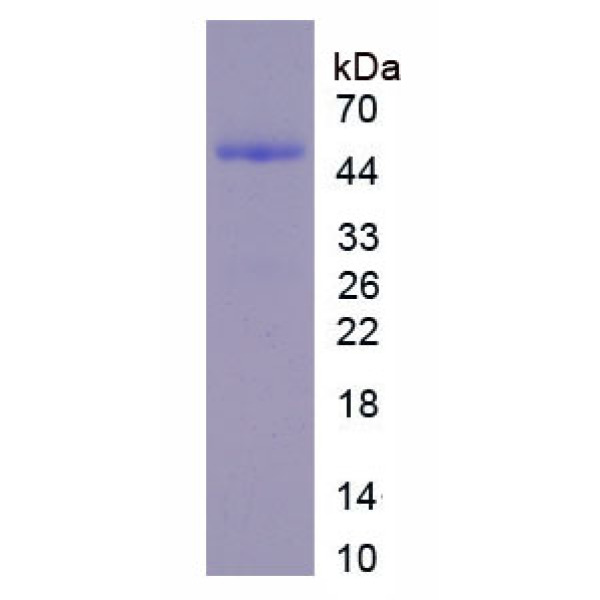 DMBT1蛋白；恶性脑肿瘤缺失蛋白1(DMBT1)重组蛋白