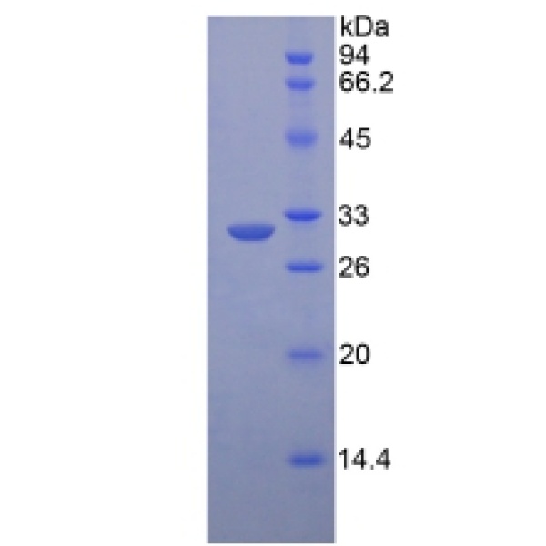 LRP6蛋白；低密度脂蛋白受体相关蛋白6(LRP6)重组蛋白