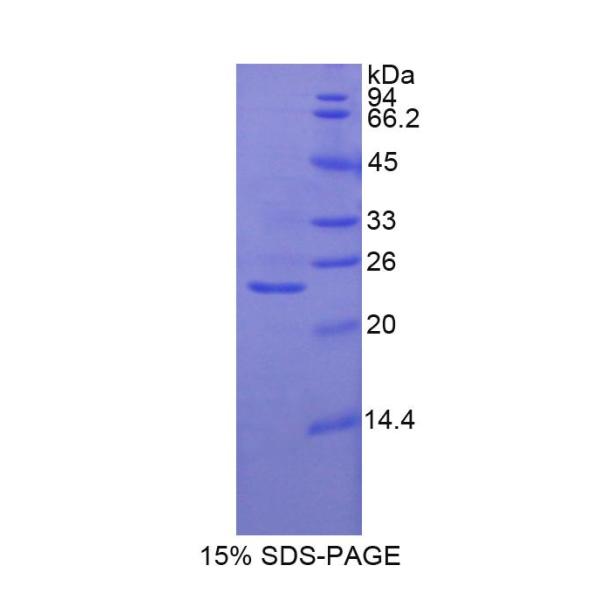 GSS蛋白；谷光甘肽合成酶(GSS)重组蛋白