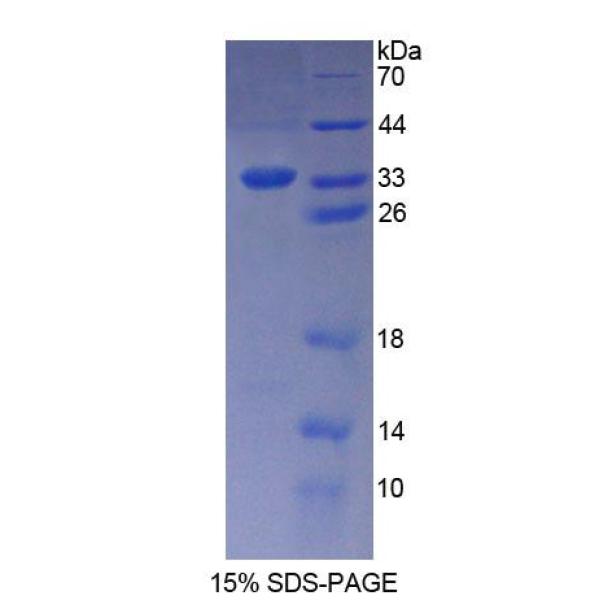 PICP蛋白；剑蛋白P60亚基A1(KATNA1)重组蛋白