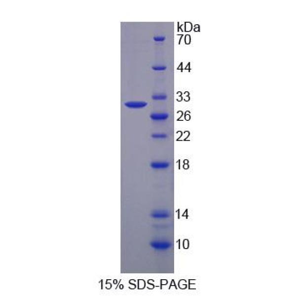 BCAR1蛋白；乳腺癌抗雌激素药物耐药性基因1(BCAR1)重组蛋白