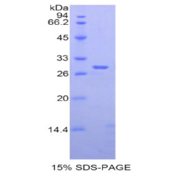 ADAM6蛋白；解整合素金属蛋白酶6(ADAM6)重组蛋白