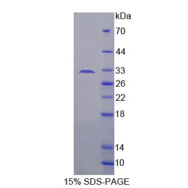 ADAM33蛋白；解整合素金属蛋白酶33(ADAM33)重组蛋白
