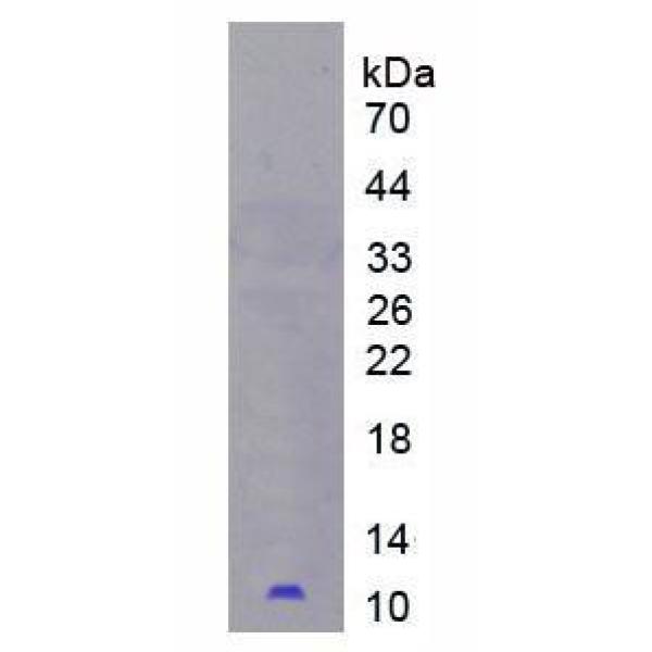 PI3蛋白；皮肤衍生肽酶抑制因子3(PI3)重组蛋白