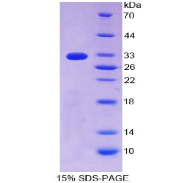 CD55蛋白；衰变加速因子(CD55)重组蛋白