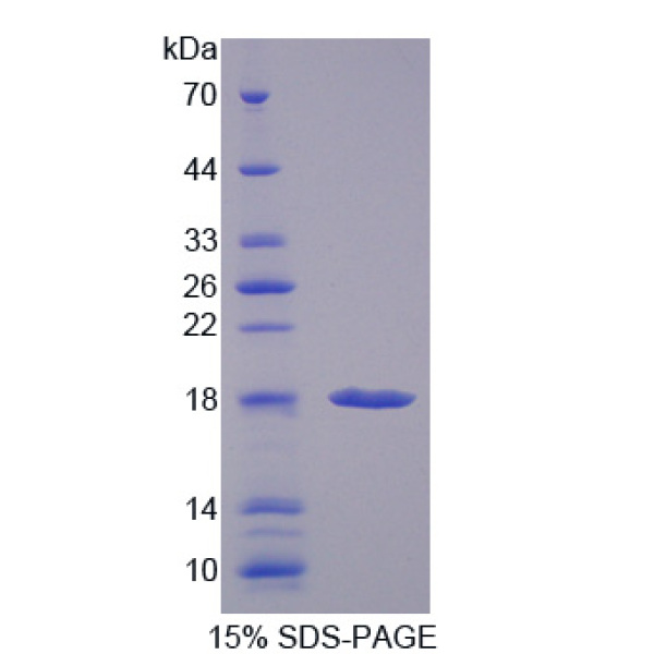 PFDN1蛋白；前折叠蛋白亚基1(PFDN1)重组蛋白