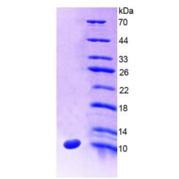 SLC30A8蛋白；溶质载体家族30成员8(SLC30A8)重组蛋白