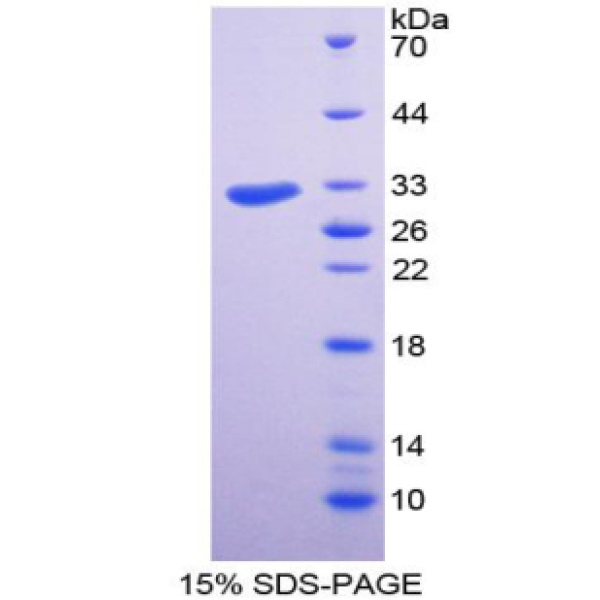 SSRP1蛋白；结构特异性识别蛋白1(SSRP1)重组蛋白