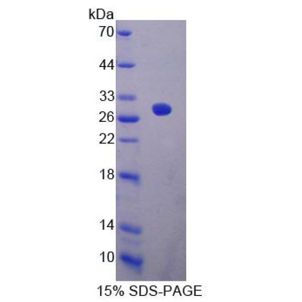 EPSTI1蛋白；上皮基质相互作用蛋白1(EPSTI1)重组蛋白
