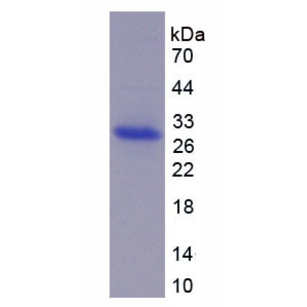 ADAM17蛋白；解整合素金属蛋白酶17(ADAM17)重组蛋白