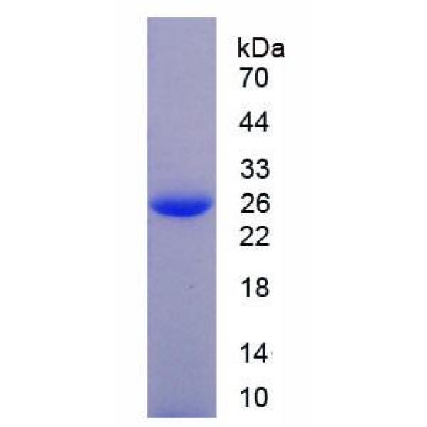 CLIC1蛋白；氯化物细胞内通道蛋白1(CLIC1)重组蛋白