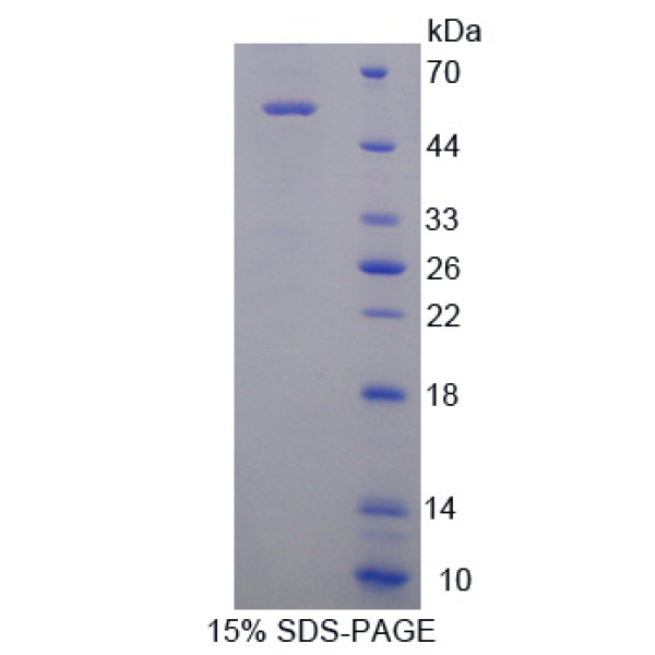 RAGE蛋白；肾肿瘤抗原(RAGE)重组蛋白