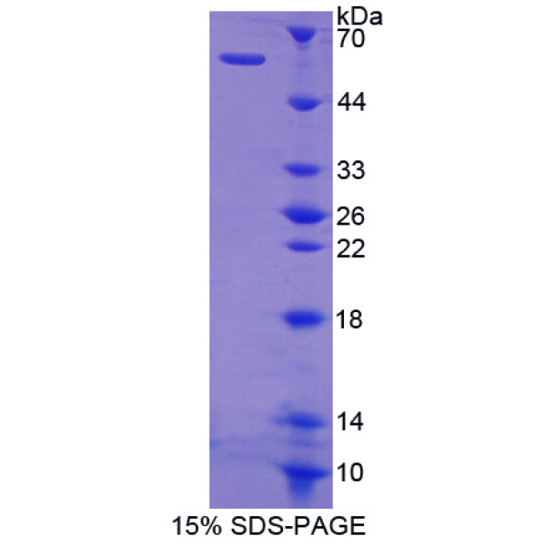 CECR1蛋白；猫眼综合征染色体区候选基因1(CECR1)重组蛋白