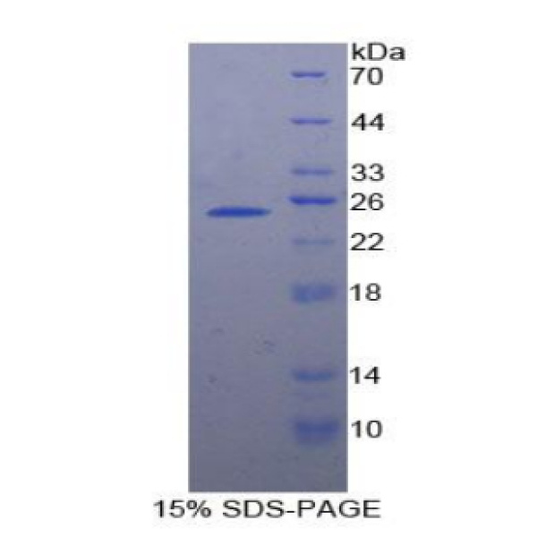 SMC3蛋白；染色体结构维持蛋白3(SMC3)重组蛋白